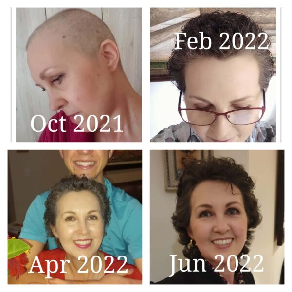 All About Hair results photo